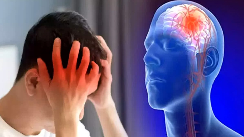 Pencegahan Penyakit Stroke Hemoragik dan Iskemik – PAFI Pangkalan Kerinci